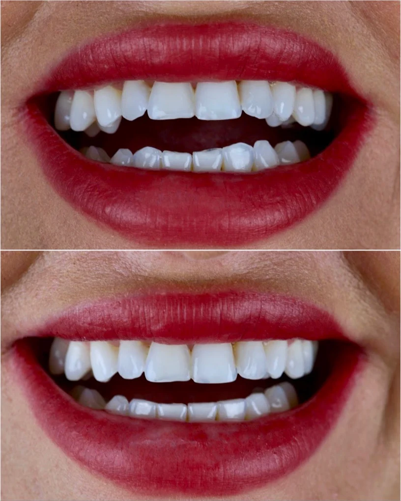 BLVD Dental Aesthetics - Dental Services in LA