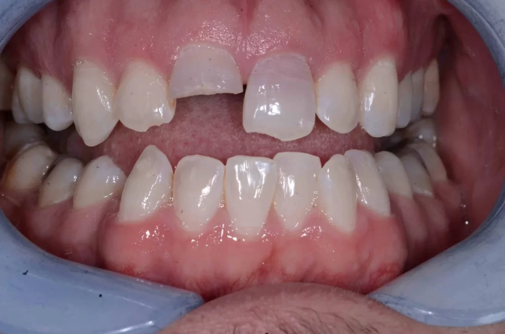 Downtown Dental - Best Dentist in Los Angeles LA