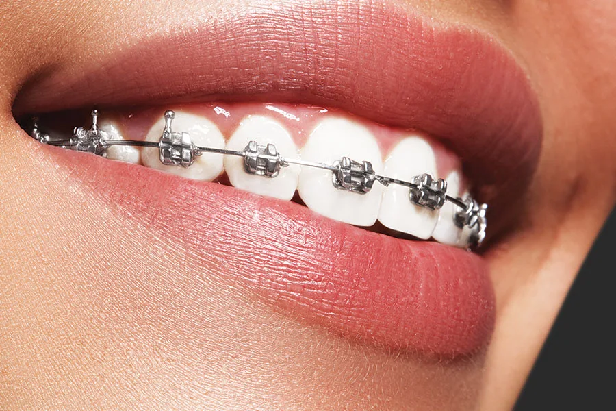 Happy Smiles Dental - Best Dentist in LA